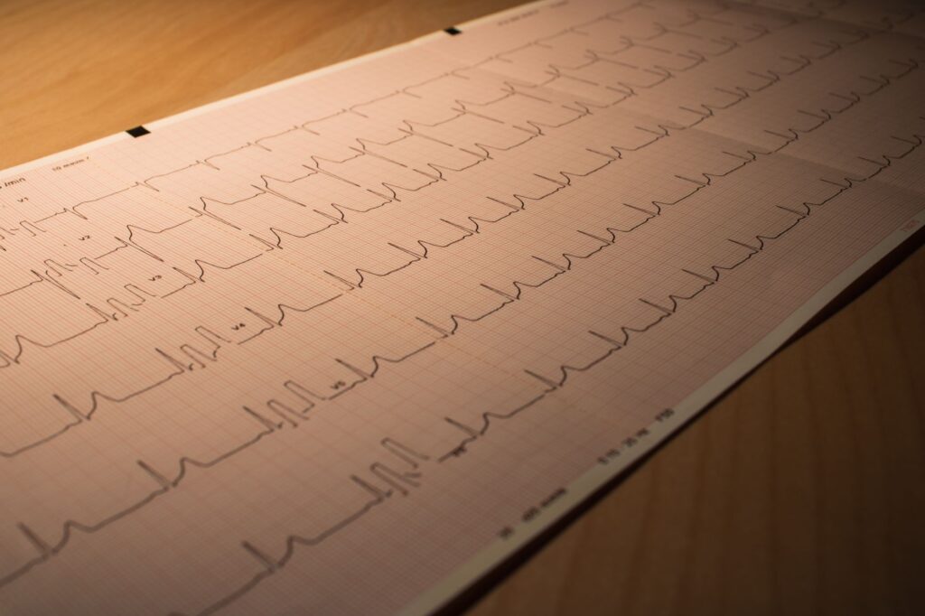 rythme cardiaque rapide