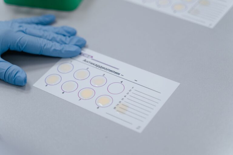 taux de CD4 et systeme immunitaire