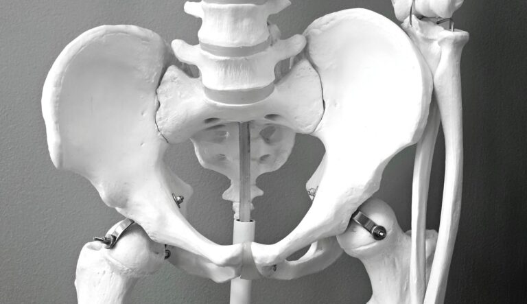 fracture du bassin