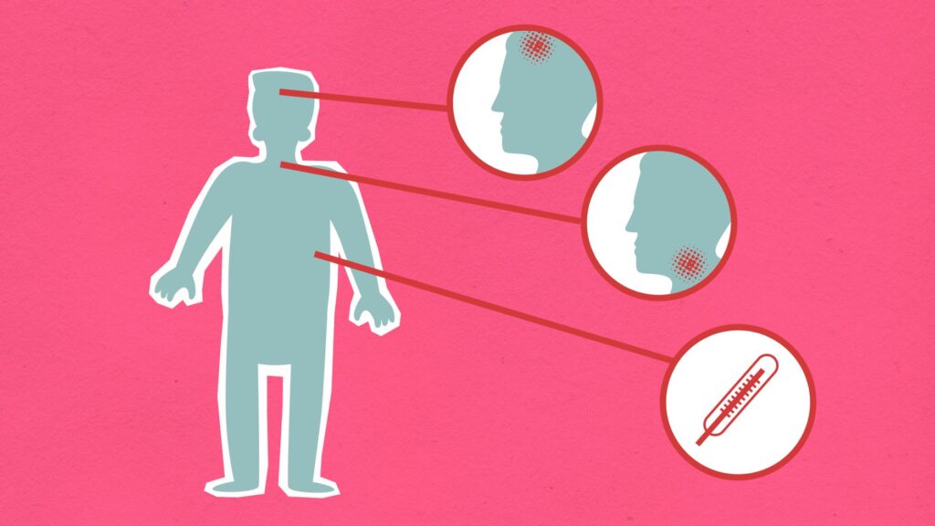 photo d'un oeil rouge ou d'une personne consultant un ophtalmologue