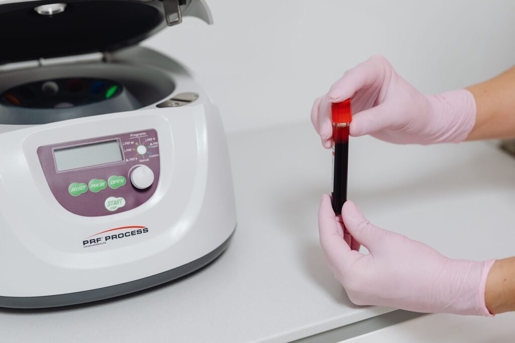 Thrombose veineuse profonde