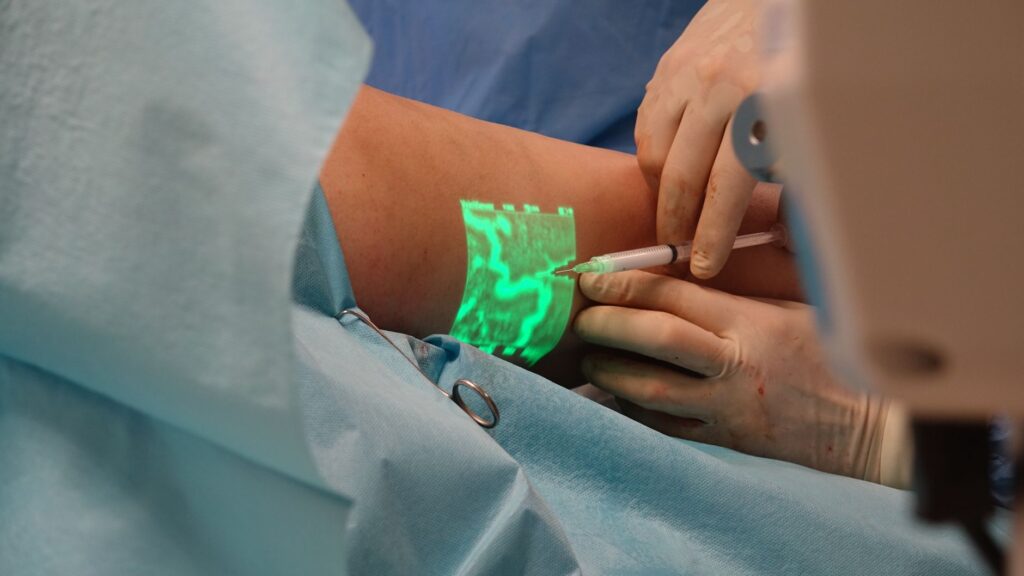Traitement de la thrombose veineuse profonde