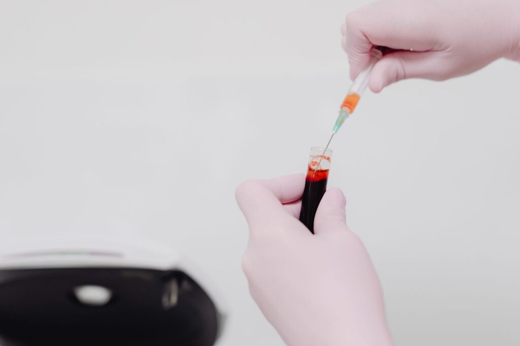 bilan de coagulation sanguine
