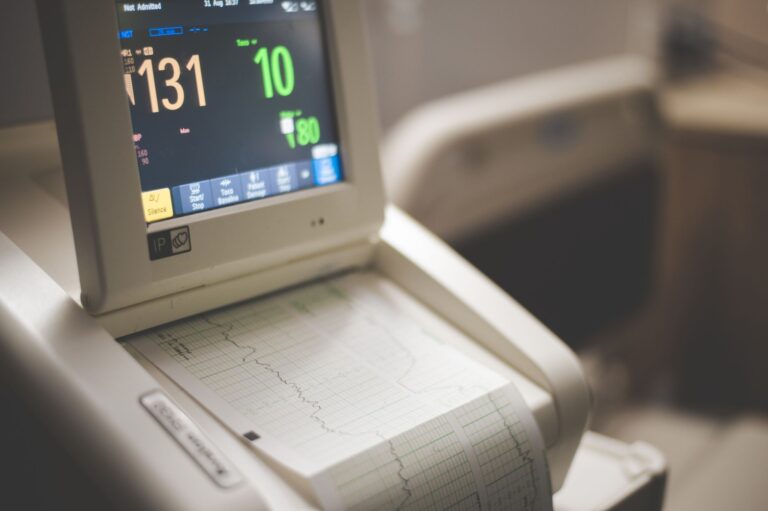 troubles du rythme cardiaque