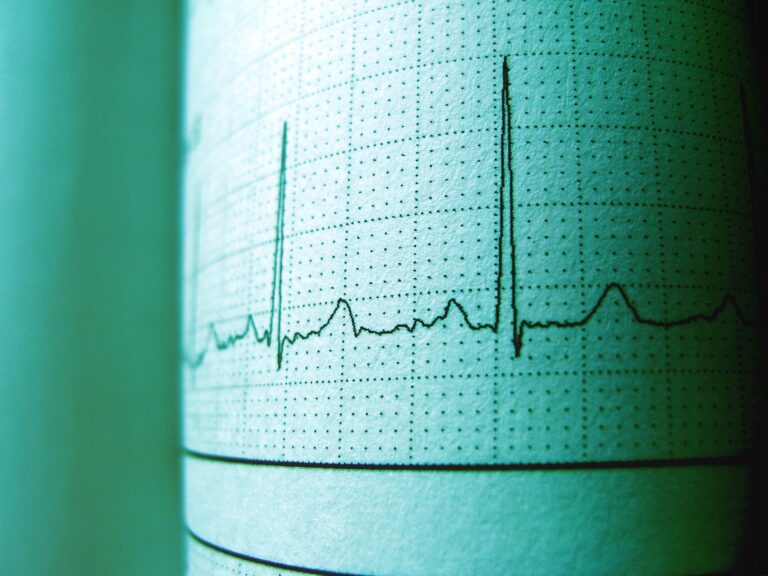 electrocardiogramme