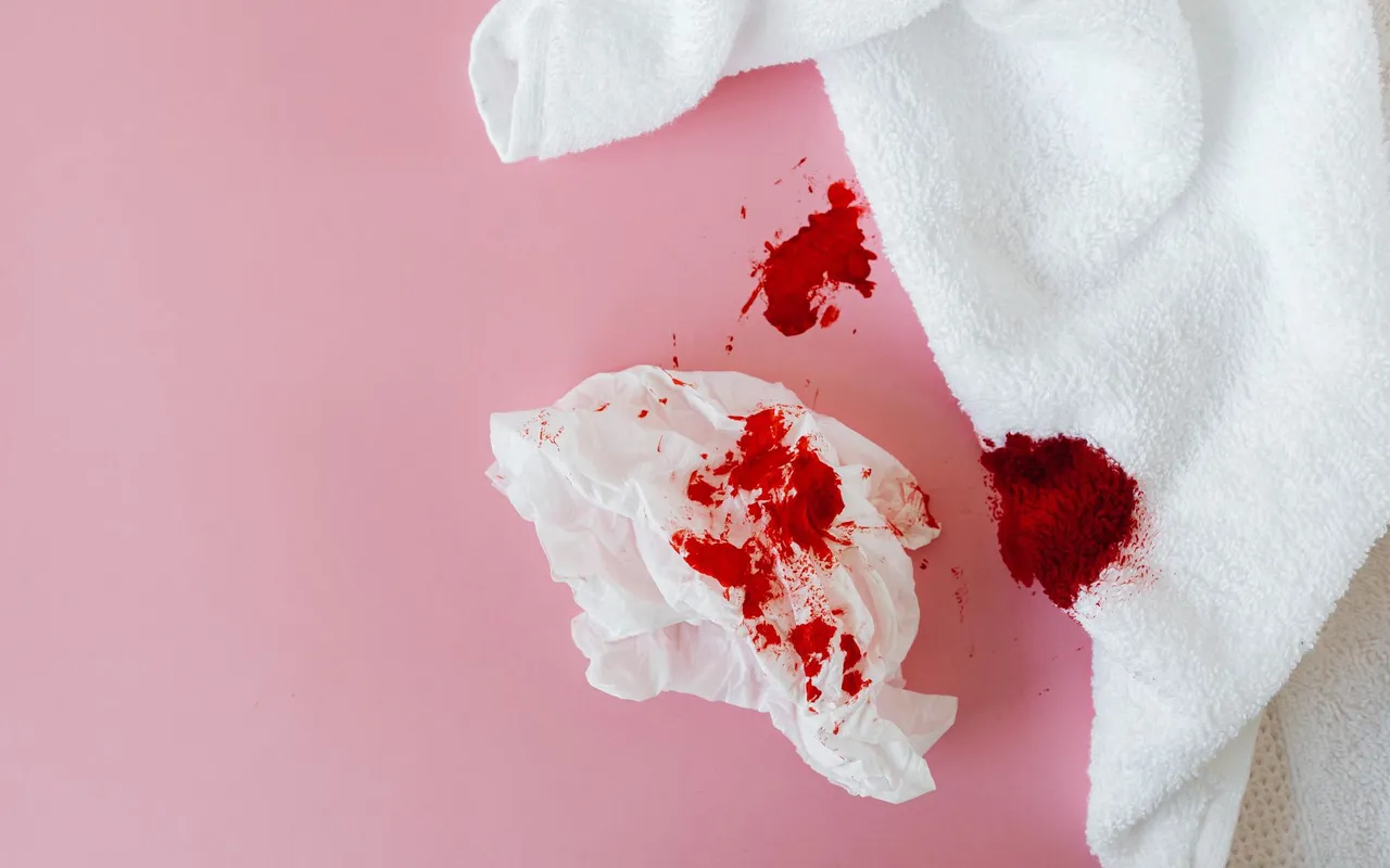Choc hémorragique : questions fréquentes sur les signes, le diagnostic et la prise en charge
