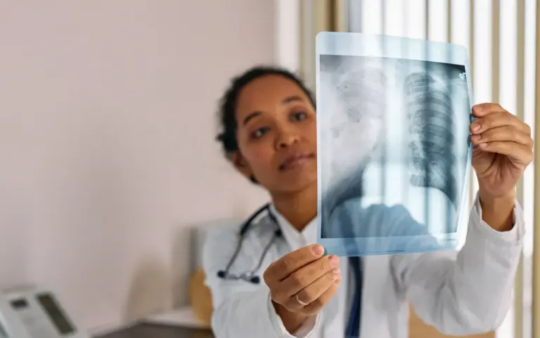 Le score de gravité embolie pulmonaire ne se choisit pas au hasard
