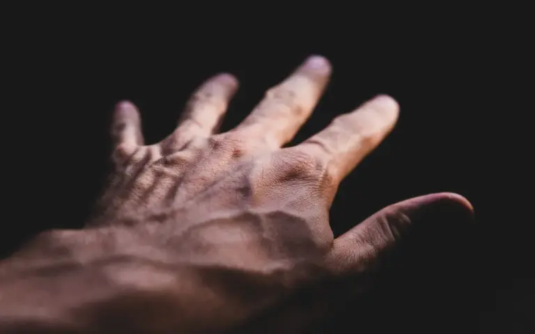 Thrombose veineuse profonde : que disent vraiment les recommandations pour les médecins ?