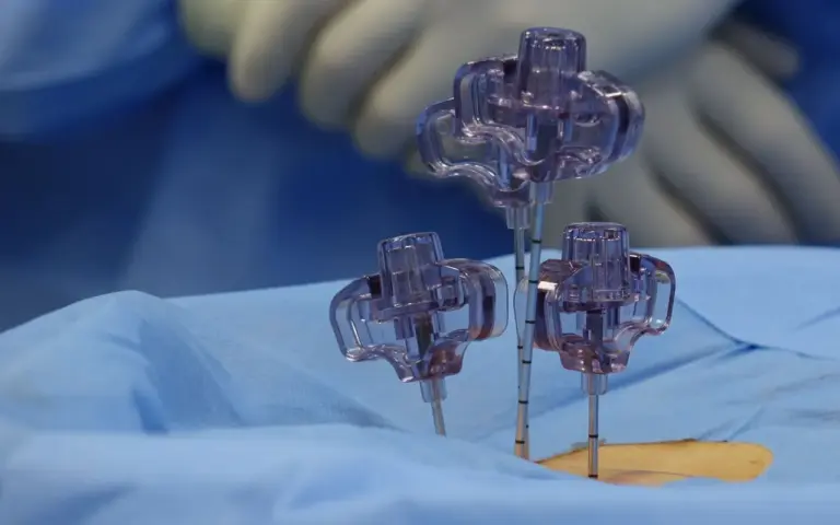 VVP ou voie veineuse centrale : ce qui change vraiment pour le patient