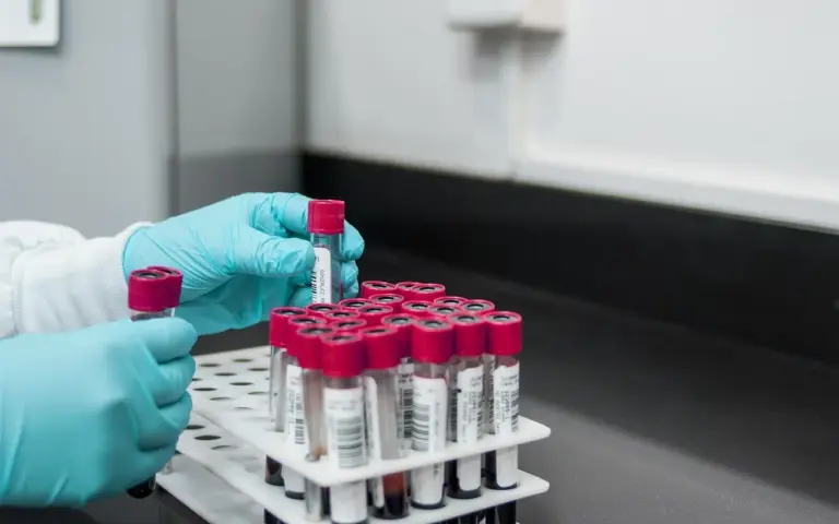 Comprendre le temps d'une analyse de sang aux urgences pour mieux anticiper votre prise en charge