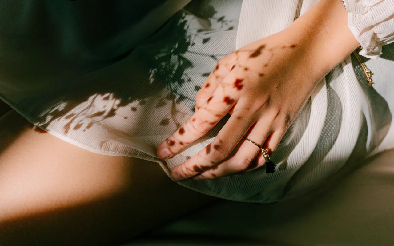 Reconnaître les symptômes d'anémie chez la femme pour agir à temps